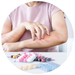 Drug Allergies