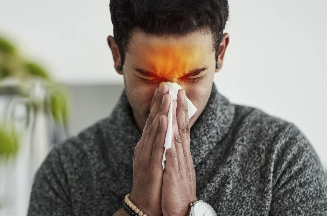 Recurrent Sinusitis
