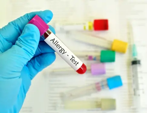 Allergy-Testing-That-Ends-the-Guessing
