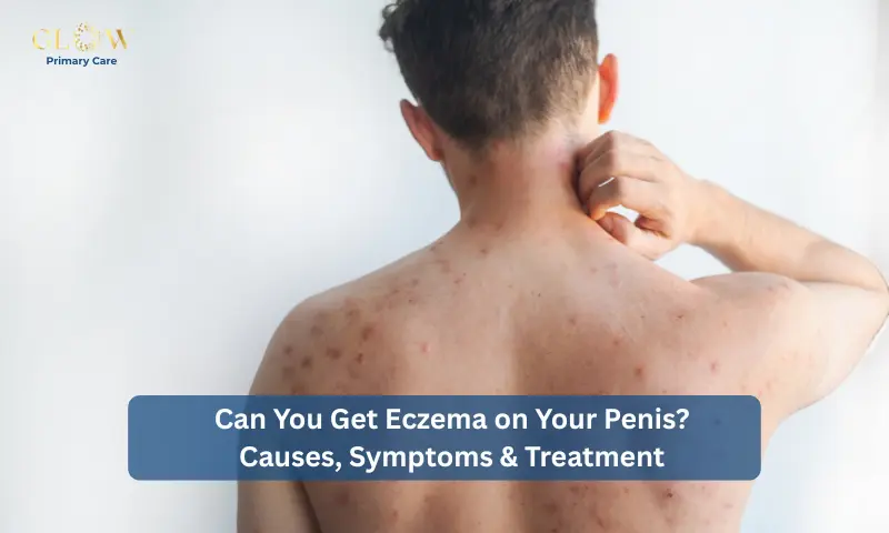 Can You Get Eczema on Your Penis Causes, Symptoms & Treatment