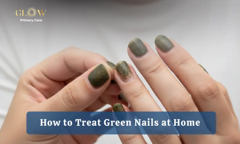 How to Treat Green Nails at Home